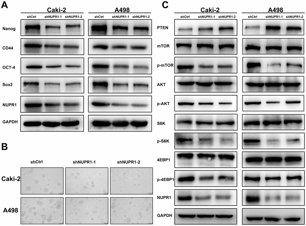 NUPR1 silencing mediated stem-like properties and suppressed the PTEN/AKT/mTOR signaling pathway in ccRCC. (A) Western blot analysis of effects of NUPR1 depletion on stemness-related biomarkers. (B) Tumor sphere assay was used for analysis of cancer stemness for NUPR1 silencing. (C) knockdown of NUPR1 increased PTEN and decreased the protein levels of p-mTOR, p-AKT, p-S6K and p-4EBP1 in ccRCC cells. (*p p p 
