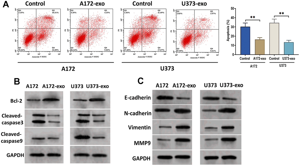 Glioma-derived exosomes inhibit glioma cell apoptosis. (A) Apoptosis of glioma cells treated with exosomes isolated from A172 or U373 cells, as detected by flow cytometry analysis. (B) Protein expression of apoptosis-related proteins Bcl-2, cleaved-caspase3, and cleaved-caspase9. (C) Protein expression of invasion-related proteins E-cadherin, N-cadherin, Vimentin, and MMP9. Data were represented as mean ± SD. ** p 