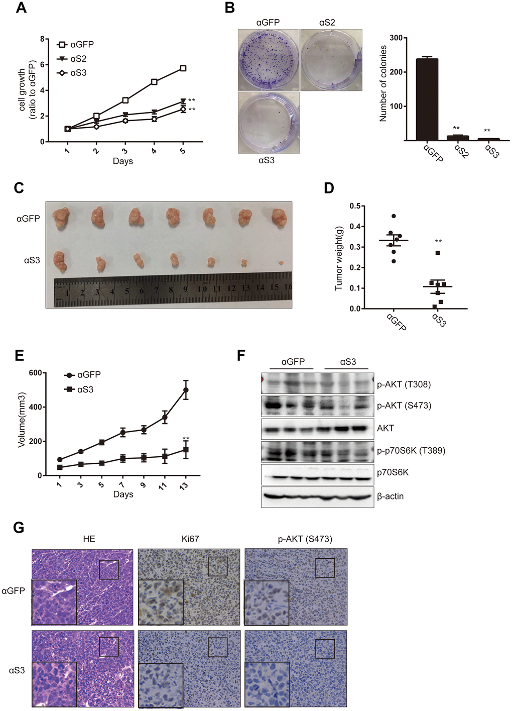 ASOs targeting snoRD126 inhibit tumour growth in vivo. (A) CCK8 assay was performed after transiently transfected HepG2 cells with snoRD126 ASOs. (B) Colony formation assay was performed in HepG2 cells after transfected with snoRD126 ASOs. Quantification of the colonies normalized to αGFP group is presented. (C) The xenograft tumours photograph after injecting snoRD126 ASOs into subcutaneous tumours. (D) Tumour weight is presented. (E) Tumour volume is presented. (F) WB assay was used to analyze the changes of the indicated protein levels in tumours. (G) Immunohistochemistry showing intratumoral injection of aS3 led to an increase of Ki67 protein and phosphorylation of AKT levels. Mean ± SD. ** p 