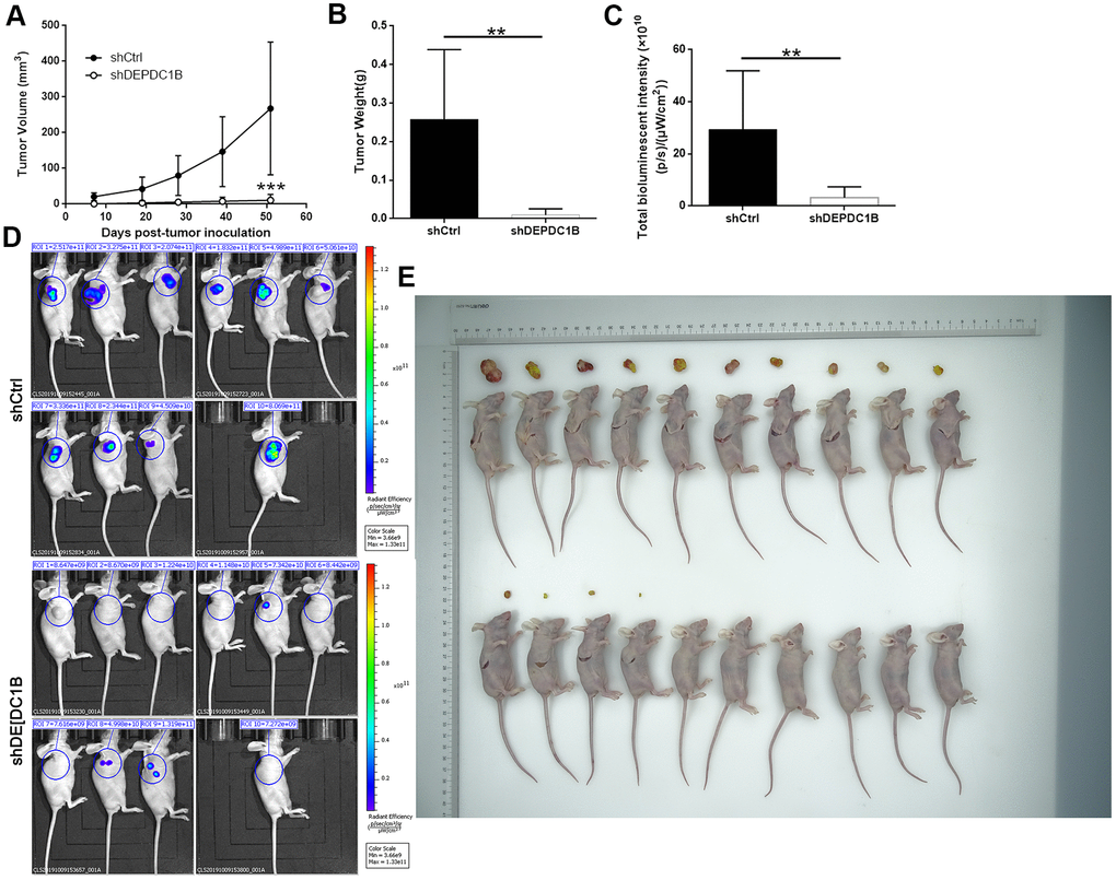 Influences of DEPDC1B knockdown on tumor in vitro. The volumes of tumors were obviously decreased in shDEPDC1B group (A). The weight (B) and fluorescence intensity (C) of tumors in shDEPDC1B were significantly lighter and weaker than that in shCtrl group (PD, E) Images of mice were taken under small animal living imaging system and digital camera. **: P 