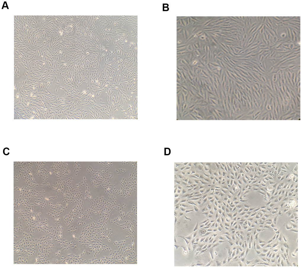 Morphological changes of RPE cells following induction by TGF-β1. After 48-h induction with 10 ng/mL TGF-β1, the shape of RPE cells became spindle-like and their arrangement was observed to become loose under a microscope (A, B) The shape of RPE cells in the blank control group under a microscope (C, D).