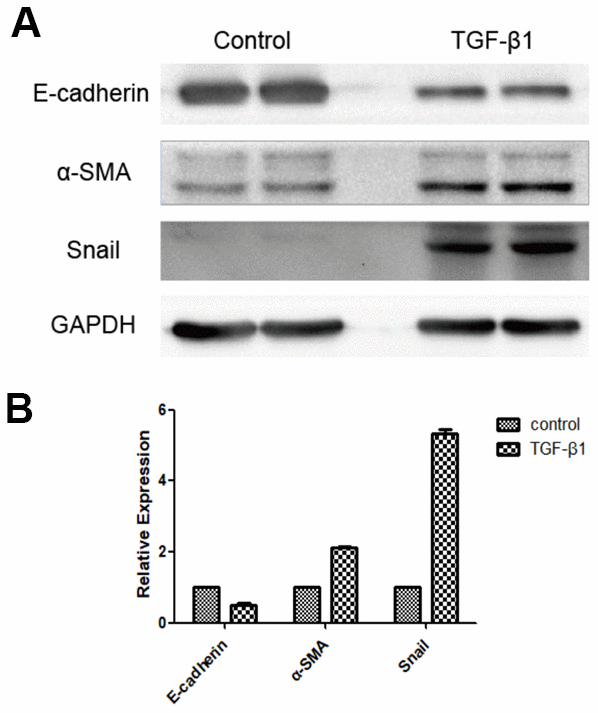 Expression of EMT marker proteins following induction of RPE cells with TGF-β1, as detected by western blot. E-cadherin expression was downregulated, whereas expression of α-SMA and Snail were upregulated in the group induced by TGF-β1 (A, B). The difference of expression levels between the two groups was statistically significant (P  0.05).