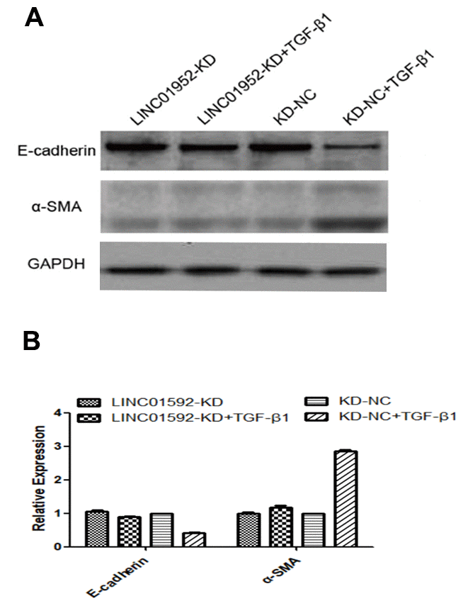 LINC01592 knockdown reduced TGF-β1-induced EMT of RPE cells. Expression of EMT molecular makers E-cadherin and α-SMA was detected by western blot. (A) Differences in expression levels between groups were statistically significant (B, P  0.05).