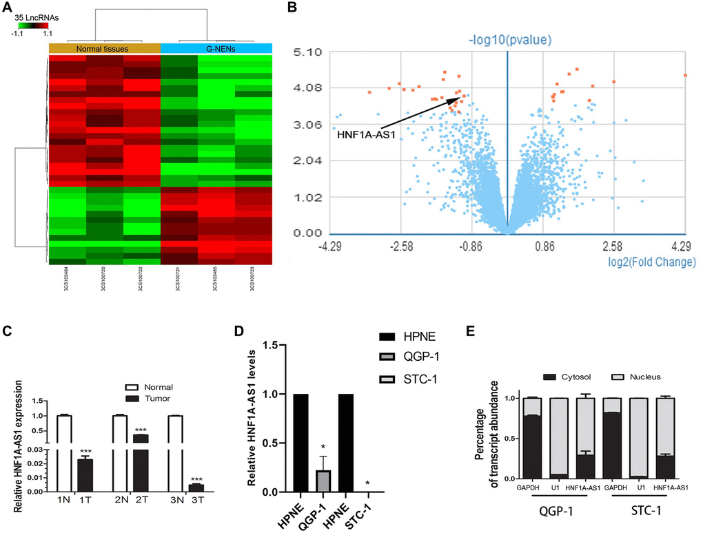 HNF1A-AS1 was down-regulated in human G-NENs tissues and GEP-NENs cells. (A) HNF1A-AS1 expression was analyzed by GeneChip assay in G-NENs tissues (n = 3) and peri-tumor tissues (>5 cm distant from cancer tissues) (n = 3). (B–C) HNF1A-AS1 was decreased in these three G-NENs tissues than in peri-tumor tissues. (D) HNF1A-AS1 expression was decreased in GEP-NENs cells than in human normal pancreatic cells HPNE as analyzed by qRT-PCR. (E) Isolation of nuclear and cytoplasmic fractions in QGP-1 and STC-1 cells suggested that HNF1A-AS1 was mainly localized in the nucleus. *p **p 