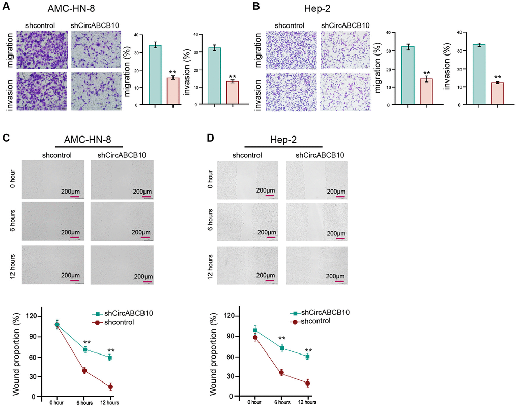 CircABCB10 enhances invasion and migration of LSCC cells. [5] The AMC-HN-8 and Hep-2 cells were treated with control shRNA or circABCB10 shRNA. (A and B) The cell migration and invasion were determined by transwell assays in the cells. (C and D) The migration and invasion were examined by wound healing assays in the cells. The wound healing proportion was shown. Data are presented as mean ± SD. Statistic significant differences were indicated: **P 