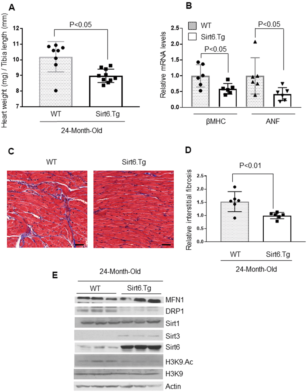 Sirt6.Tg mice are protected from aging induced cardiac hypertrophy. (A) Heart weight to tibia length (HW/TL) ratio of 24-month-old Wild type and 24-month-old Sirt6 transgenic (Sirt6.Tg) mice. Values are mean ± SE, n = 8-10. (B) Expression levels of βMHC and ANF mRNA levels in Wild type and Sirt6.Tg mice, mean ± SE, n=6 mice. (C) Representative sections of hearts stained with Masson's trichrome to detect fibrosis (blue); scale bars, 20 μm. (D) Quantification of cardiac fibrosis in Wild type and Sirt6.Tg mice. Mean ± SE, n = 6. (E) Heart lysates of Wild type and Sirt6.Tg mice were subjected to immunoblotting using indicated antibodies. Representative blots of three different mice in each group are shown, n = 6. (Quantification of blots is given in Supplementary Figure 6A–6F).