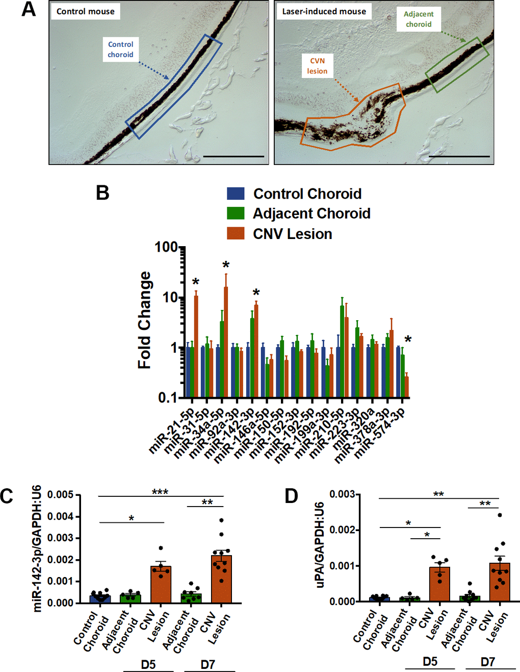 MiR-142-3p is overexpressed in a laser-induced CNV mouse model. (A) Cryosections of control mouse (untreated) and laser-induced mouse delineating the different regions of interest (ROI). These ROIs, namely control choroid (in blue), adjacent choroid (in green) and CNV lesion (in orange), were isolated by laser microdissection. Scale bar = 250 μm. (B) MicroRNA expression in CNV lesion and adjacent choroid compared to control choroid, 7 days after laser induction. Results of CNV lesion and adjacent choroid are expressed as fold change to control choroid. Results are presented as mean +- SEM. One-way ANOVA followed by multiple comparisons test (n = 5 per experimental group). (C, D) Overexpression of miR-142-3p (C), and uPA (D), a CNV-disease marker, at day 5 (D5) and day 7 (D7). MiR-142-3p and uPA are specifically overexpressed in CNV lesion 5 and 7 days post laser induction. qRT-PCR results are presented as mean +- SEM. One-way ANOVA + multiple comparisons test (n = 10 for control choroid, n = 5 for adjacent choroid and CNV lesion D5, n = 10 for adjacent choroid and CNV lesion D7) (* = p ≤ 0.05; ** = p ≤ 0.01; *** = p ≤ 0.001).