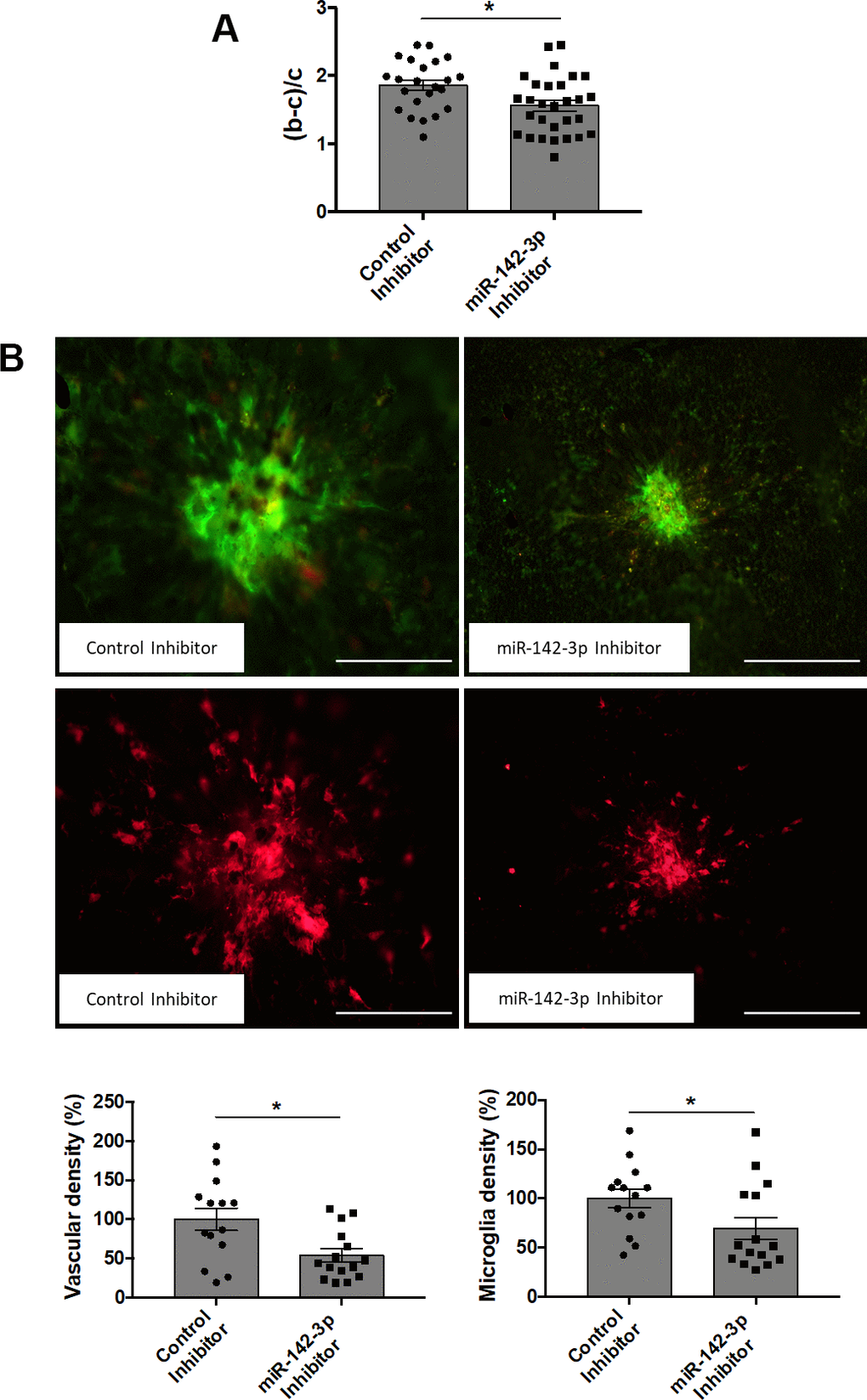 Inhibition of miR-142-3p in a laser-induced CNV mouse model decreases both vascular and inflammatory phenotypes. (A) OCT measurement presented as (b-c)/c ratios where b is the CNV lesion thickness and c is the adjacent choroid thickness. b and c were measured just prior to sacrifice (n = 23-29 per experimental group). (B) Flat-mounted choroids showing vascular (in green) and microglia (in red) density and corresponding quantification. Scale bar = 250 μm (n = 14-15 per experimental group). All results are presented as mean +- SEM. Mann Whitney test (* = p ≤ 0.05).