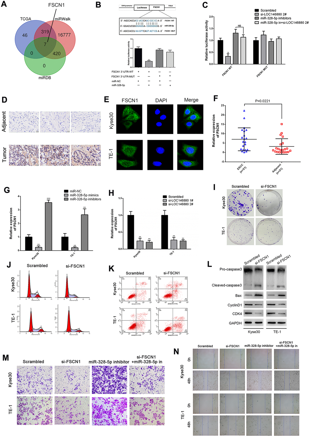 FSCN1 is a direct target of miR-328-5p and enhances the progression of ESCC cells. (A) TCGA, miRDB and miRWalk database analyses show that FSCN1 is a potential miR-328-5p target gene (FGF19, EN1, ADAM8, ELFN2, FSCN1, CLDN6, IFIT1). (B) The predicted miR-328-5p seed region in the wild-type (WT) and mutated (Mut) 3′UTR of FSCN1 is shown in the top panel. Dual luciferase reporter assay results (bottom panel) show relative luciferase activity of Kyse30 cells co-transfected with luciferase reporter plasmids containing wild-type or mutated 3′UTR of FSCN1 (WT or Mut) and miR-328-5p mimics, miR-NC act as control. (C) Dual luciferase reporter assay results show luciferase activity in control or LOC146880-silenced Kyse30 cells transfected with luciferase reporter vector with wild-type or mutated 3′UTR of FSCN1 plus miR-NC or miR-328-5p inhibitors. (D) IHC assay shows higher FSCN1 expression level in tumor tissues than in adjacent tissues. (E) ICC assay shows localization of FSCN1 in the cytoplasm and nucleus of ESCC cells. (F–H) QRT-PCR analysis shows expression levels of FSCN1 transcripts in (F) 21 pairs of esophageal cancer and adjacent normal esophageal tissues, (G) ESCC cells transfected with miR-NC, miR-328-5p mimics, and miR-328-5p inhibitors, and (H) control and LOC146880-silenced ESCC cells. (I) Colony formation assay results show the viability of si-NC and si-FCSN1-transfected Kyse30 and TE-1 cells. (J–K) Flow cytometry analysis shows (J) apoptotic rate and (K) cell cycle distribution of si-NC and si-FCSN1-transfected Kyse30 and TE-1 cells. (L) Western blot analysis shows the levels of apoptosis-related proteins (cleaved caspase 3 and Bax) and cell cycle proteins (cyclinD1 and CDK4) in si-NC and si-FCSN1-transfected Kyse30 and TE-1 cells. (M–N) Wound-healing and Transwell invasion assay results show (M) migration and (N) invasiveness of si-NC and si-FCSN1-transfected Kyse30 and TE-1 cells. *P **P ***P 