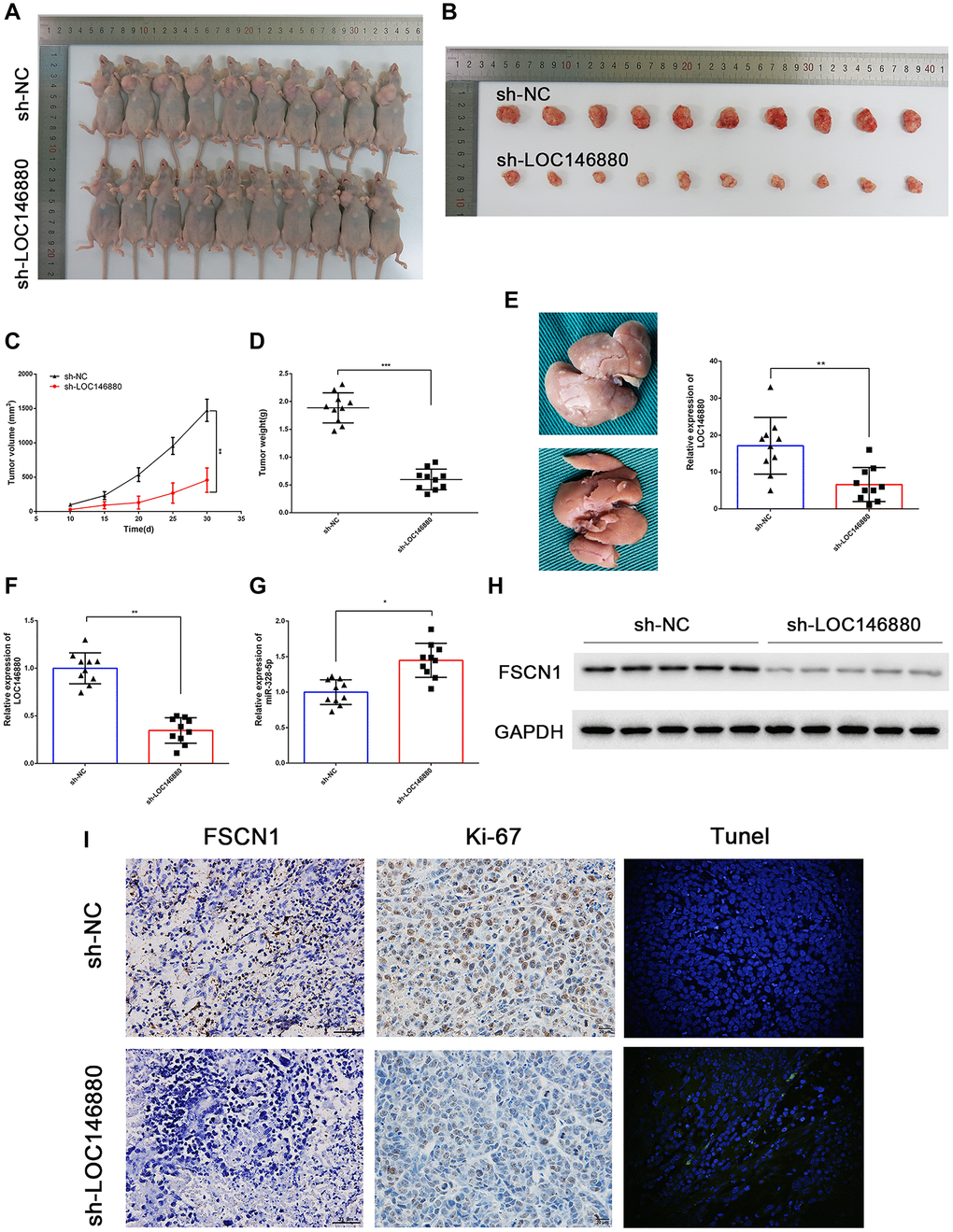 LOC146880 silencing reduces in vivo ESCC growth and progression. (A) Representative images show nude mice xenografted with sh-NC-transfected Kyse30 cells (upper, n = 10) and sh-LOC146880-transfected Kyse30 cells (lower, n = 10). (B) Representative images show ESCC-derived tumor xenografts from nude mice injected with sh-NC-transfected Kyse30 cells (upper) and sh-LOC146880-transfected Kyse30 cells (lower). (C) Tumor volumes of sh-NC and sh-LOC146880 groups of ESCC xenograft tumors in nude mice. (D) Tumor mass of sh-NC and sh-LOC146880 groups of ESCC xenograft tumors in nude mice. (E) Representative images and quantitative analysis show the number of metastatic tumor nodules in the liver of nude mice belonging to sh-NC and sh-LOC146880 groups. (F–G) QRT-PCR analysis of (F) LOC146880 and (G) miR-328-5p expression levels in xenograft tumors from sh-NC and sh-LOC146880 groups. (H) Western blot analysis shows FSCN1 protein levels in xenograft tumors from sh-NC and sh-LOC146880 groups. (I) Immunohistochemical staining and Tunel Staining show3 expression levels of FSCN1, Ki-67 and apoptotic cells in xenograft tumor sections from sh-NC and sh-LOC146880 groups.