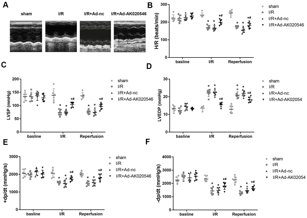 LncRNA AK020546 alleviated I/R injury-induced cardiac dysfunction in vivo. (A–F) Echocardiographic parameters of rats including LVSP, LVEDP, ±dp/dt, and heart rate were evaluated with an ultrasound device (n = 8). *p #p 
