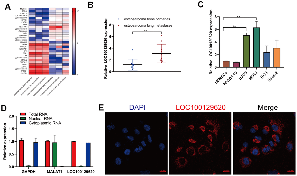 LncRNA LOC100129620 is upregulated in osteosarcoma lung metastasis tissue and osteosarcoma cell lines. (A) Heatmap analysis of the changes of gene expression in osteosarcoma bone primary tissues and osteosarcoma lung metastases. (B) LOC100129620 expression was analyzed by qRT-PCR in osteosarcoma bone primary tissues and osteosarcoma lung metastases. Primary tissues, n = 10; lung metastases, n = 10. (C) The expression of LOC100129620 in hBMSCs, hFOB1.19, and osteosarcoma cell lines (U2OS, MG63, HOS, and Saos-2) was detected by qRT-PCR. (D) The nuclear and cytoplasmic levels of LOC100129620 in U2OS cells were detected by qRT-PCR. GAPDH and lncRNA MALAT1 were used as controls. (E) The expression of LOC100129620 in U2OS cells was detected by in situ hybridization. Blue indicates nuclei (stained with DAPI), and red indicates LOC10012960. Scale bar, 20 μm. Statistical analysis was conducted using Student’s t-test. Values are means ± SD. *P P 