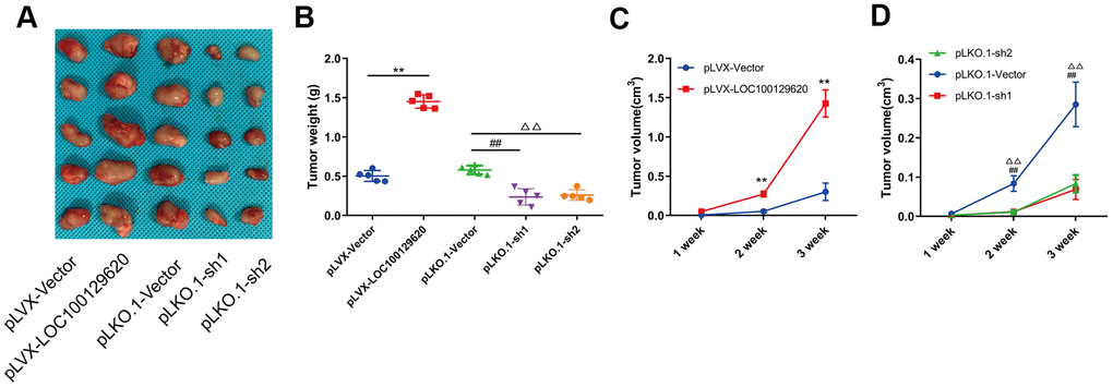 LncRNA LOC100129620 regulates osteosarcoma progression in vivo. (A) U2OS cells with LOC100129620 overexpression or knockdown were transplanted subcutaneously into nude mice (n = 5). (B) Tumor weight of osteosarcoma with LOC100129620 overexpression or knockdown. (C) Tumor weight of osteosarcoma with LOC100129620 overexpression. (D) Tumor weight of osteosarcoma with LOC100129620 knockdown. Statistical analysis was conducted using Student’s t-test. Values are means ± SD. **p ##P ΔΔP 