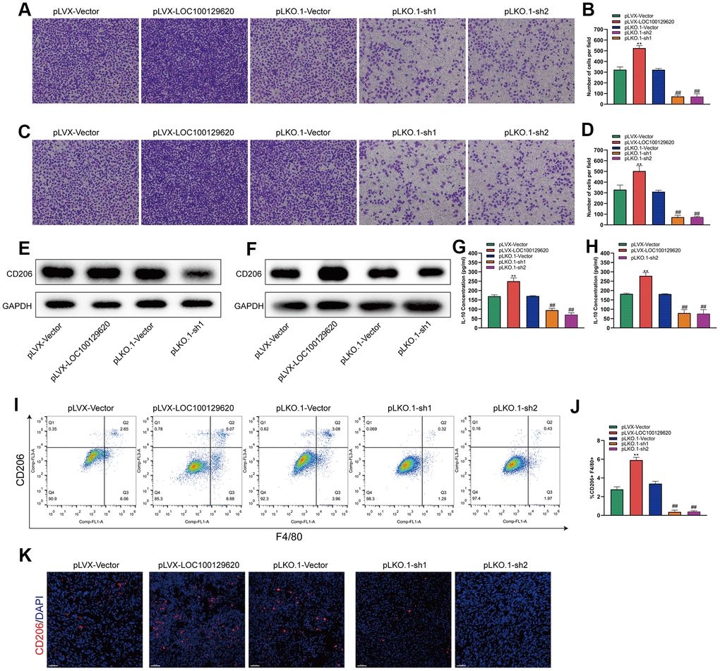 LncRNA LOC100129620 regulates osteosarcoma-associated macrophage polarization. (A) Transwell assay to detect the invasion ability of RAW264.7 cells treated with cell culture supernatant isolated from U2OS cells with LOC100129620 overexpression or knockdown. (B) Quantitative analysis of the Transwell assay results of RAW264.7 cells treated with cell culture supernatant isolated from U2OS cells with LOC100129620 overexpression or knockdown. (C) Transwell assay to detect the invasion ability of RAW264.7 cells treated with cell culture supernatant isolated from MG63 cells with LOC100129620 overexpression or knockdown. (D) Quantitative analysis of the Transwell assay results of RAW264.7 cells treated with cell culture supernatant isolated from MG63 cells with LOC100129620 overexpression or knockdown. (E) Western blot to detect the expression of CD206 in RAW264.7 cells treated with cell culture supernatant isolated from U2OS cells with LOC100129620 overexpression or knockdown. (F) Western blot to detect the expression of CD206 in RAW264.7 cells treated with cell culture supernatant isolated from MG63 cells with LOC100129620 overexpression or knockdown. (G) ELISA to detect the expression of IL-10 in cell culture supernatant isolated from U2OS cells with LOC100129620 overexpression or knockdown. (H) ELISA to detect the expression of IL-10 in cell culture supernatant isolated from MG63 cells with LOC100129620 overexpression or knockdown. (I) The percentages of total (F4/80+) and M2 (CD206+) macrophages in the tumor tissues were assayed by flow cytometry. (J) Statistical analysis of the percentages of total (F4/80+) and M2 (CD206+) macrophages in the tumor tissues. (K) Immunofluorescence analysis of the percentage of M2 (CD206+) macrophages in the tumor tissues. Statistical analysis was conducted using Student’s t-test. Values are means ± SD. **P ##P 