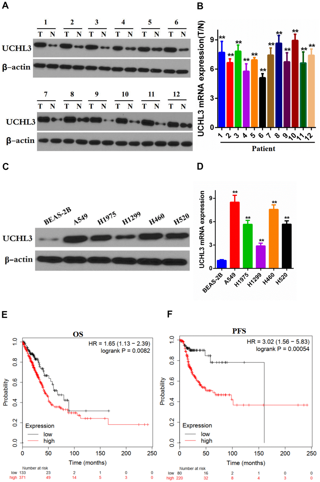 Expression of UCHL3 is up-regulated in non-small cell lung cancer tissues and cell lines. (A, B) Western blot analysis (A) and real-time PCR (B) analysis of UCHL3 expression in 12 paired tumor (T) tissues and adjacent non-tumor (N) tissues. (C, D) Western blot analysis (C) and real-time PCR (D) analysis of UCHL3 expression in normal lung epithelial cell lines BEAS-2B and non-small cell lung cancer (NSCLC) cell lines A649, H1975, H1299, H460, H520. (E, F) Kaplan-Meier analysis of OS (E), PFS (F) in NSCLC patients. Data was obtained from Kaplan-Meier Plotter website. OS, overall survival. PFS, progression-free survival. β-actin was used as a loading control. **P 