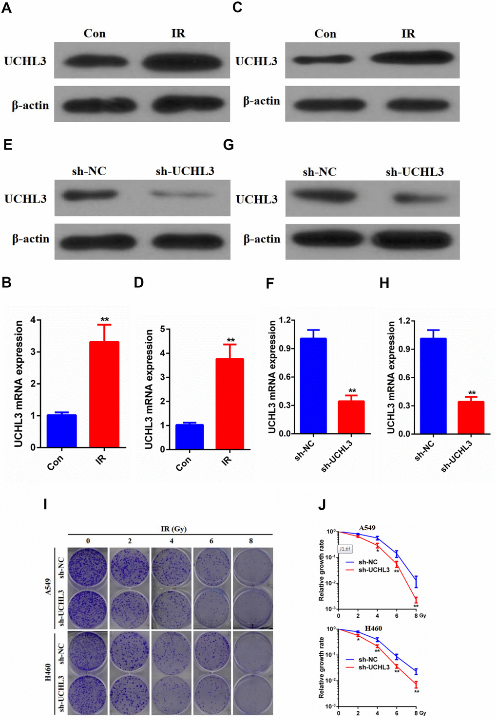 UCHL3 knockdown enhanced radio-sensitivity of non-small cell lung cancer cells in vitro. (A, B) Western blot analysis (A) and real-time PCR (B) analysis of UCHL3 expression in A549 control cells and cells exposed to ionizing radiation (IR). (C, D) Western blot analysis (C) and real-time PCR (D) analysis of UCHL3 expression in H460 control cells and cells exposed to IR. (E, F) Western blot analysis (E) and real-time PCR (F) analysis of UCHL3 expression in A549 cells transfected with sh-NC or sh-UCHL3. (G, H) Western blot analysis (G) and real-time PCR (H) analysis of UCHL3 expression in H460 cells transfected with sh-NC or sh-UCHL3. (I) Colony formation assay of A549 cells and H460 cells were transfected with sh-NC or sh-UCHL3 and received the corresponding radiation does (0, 2, 4, 6, 8 Gy). (J) Relative growth rate in A549 cells and H460 cells has shown. The relative growth rates are reported as the mean ± s.d. from three independent experiments. β-actin was used as a loading control. **P 