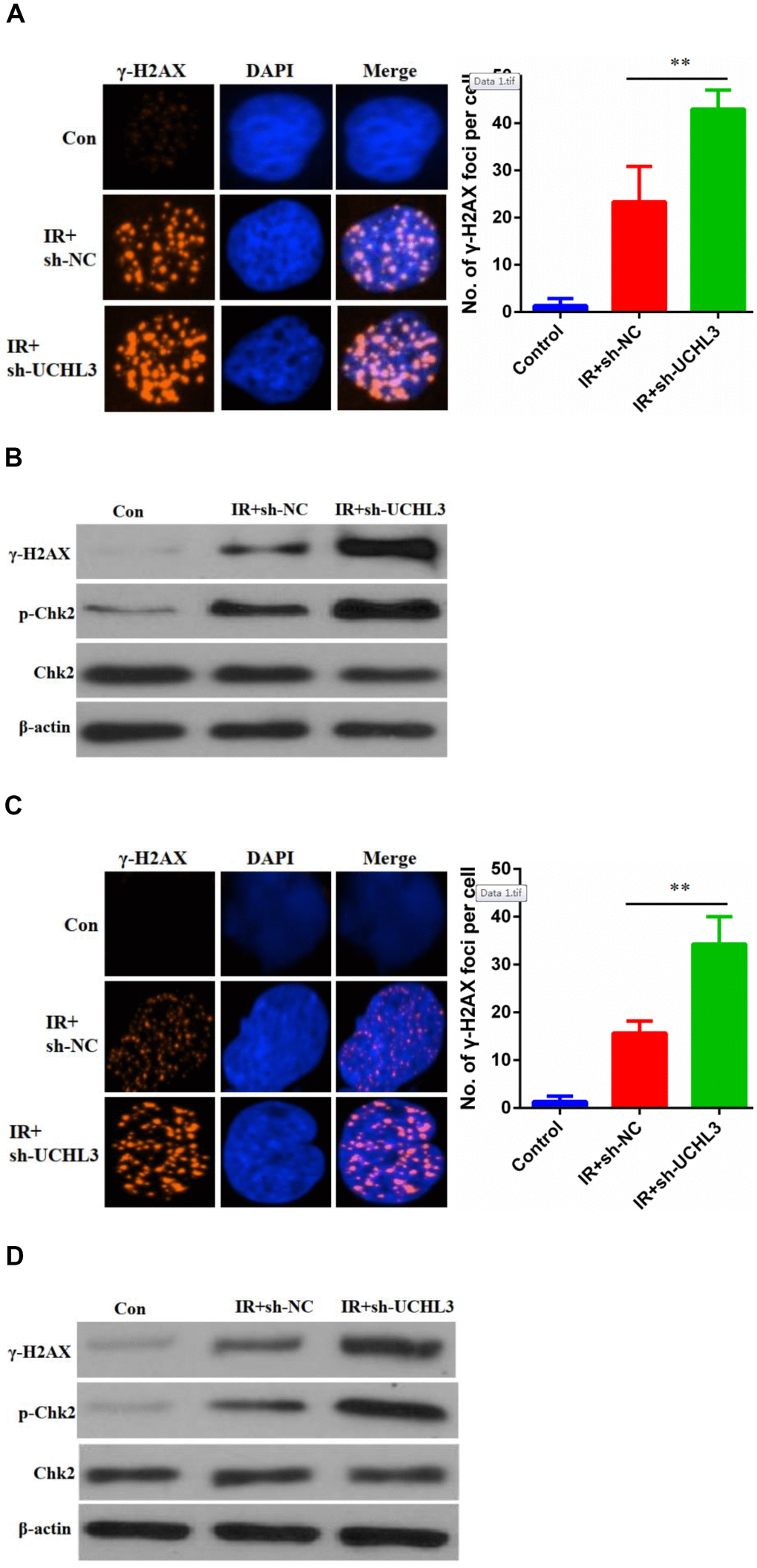 UCHL3 knockdown enhanced ionizing radiation-induced DNA damage. (A) γ-H2AX staining in A549 cells transfected with sh-NC and sh-UCHL3 after exposure to ionizing radiation (IR). (B) Western blot analysis of γ-H2AX, p-Chk2, Chk2 after A549 cells treated with indicated treatment. (C) γ-H2AX staining in H460 cells transfected with sh-NC and sh-UCHL3 after exposure to IR. (D) Western blot analysis of γ-H2AX, p-Chk2, Chk2 after H460 cells treated with indicated treatment. β-actin was used as a loading control. **P 