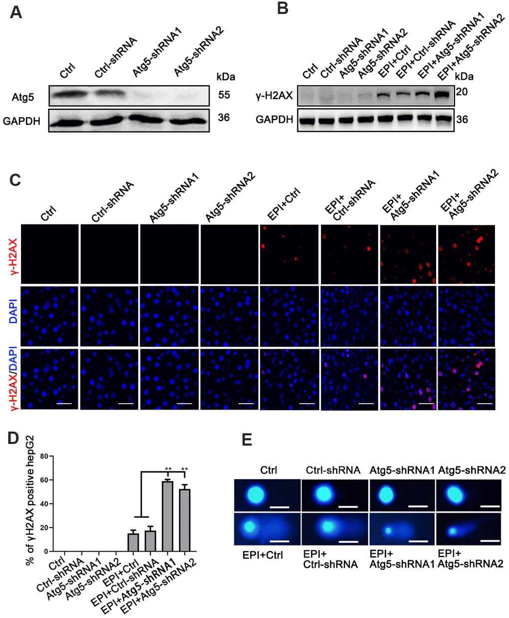 Loss of autophagy increases DNA damage. (A) Western analysis of Atg5 in cells infected with either Atg5-shRNA1/shRNA2 lentivirus or empty lentivirus control vector; GAPDH was used as a loading control. (B) Western analysis of γ-H2AX protein levels in epirubicin-treated (2 μM; 24 h) cells. (C) Accumulation of γ-H2AX analyzed by immunofluorescence as foci formation in epirubicin (4 μM; 6 h) treated cells (scale bar, 100μm). (D) Quantification of γ-H2AX+ cells. Data are expressed as mean±SD. ** P≤0.01. (E) Wild-type, vector control, and sh-Atg5 cells were treated with 4 μM epirubicin for 12 h, then cells were analyzed by comet assay (scale bar, 20μm).