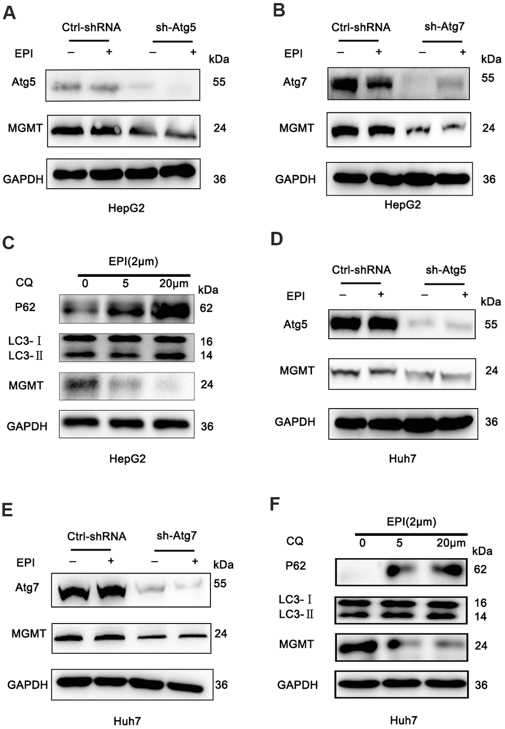 Loss of autophagy decreases MGMT expression. (A, B) HepG2 cells were infected with sh-Atg5/Atg7 HepG2 or empty lentivirus vector, treated with 2 μM epirubicin for 24 h, and levels of MGMT were determined by western blot assay; GAPDH was used as a loading control. (C) Western analysis of MGMT in wild-type HepG2 cells treated with 2 μM epirubicin for 24 h, followed by 24 h incubation with CQ. (D, E) Western analysis of MGMT in wild-type Huh7 cells infected with Atg5-shRNA lentivirus or Atg7-shRNA lentivirus, and treated with 2 μM epirubicin for 24 h. (F) Western analysis of MGMT in wild-type Huh7 cells treated 24 h with 2 μM epirubicin, followed by 24 h incubation with the indicated CQ concentrations.