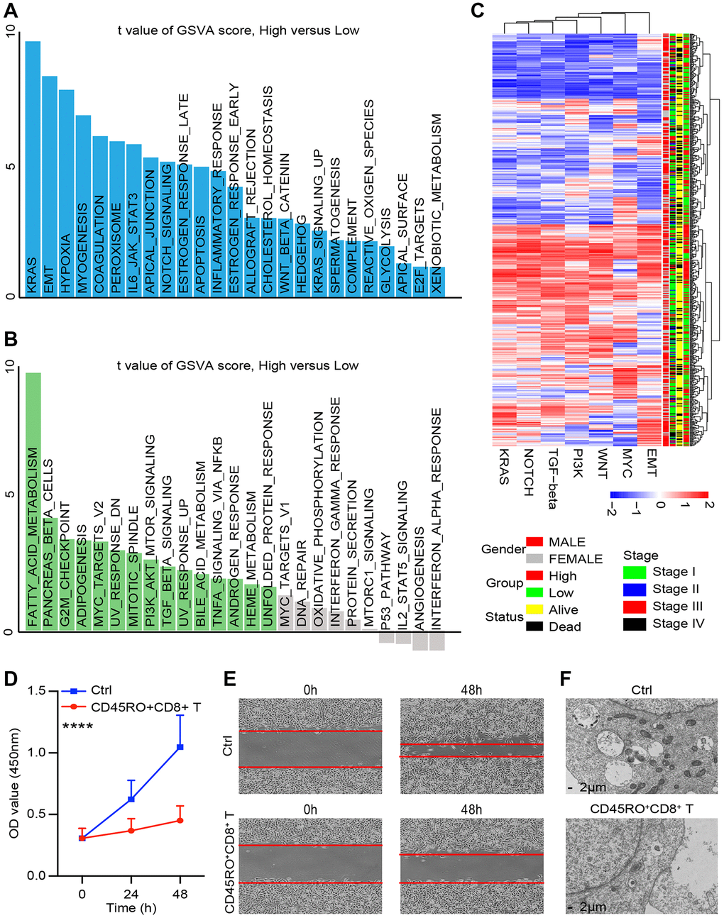 CD45RO+CD8+ T cells effectively inhibit ccRCC progression. We co-cultured CD45RO+CD8+ T cells with Caki-2 cells for 48hours and Caki-2 cells were collected. (A, B) Different genes of Caki-2 with/without CD45RO+CD8+ T cells treated were clustering into upregulated pathways (A) and downregulated pathways (B). (C) Heatmap of oncogenic DEPs based on ssGSEA score and their clinical relationships from ccRCC patients according to CD45RO level. (D) Proliferation ability of Caki-2 cells with/without CD45RO+CD8+ T cells treated. (E) Wound healing assay was used to test the invasion ability of Caki-2 cells. (F) Electron microscope images of Caki-2 cells.