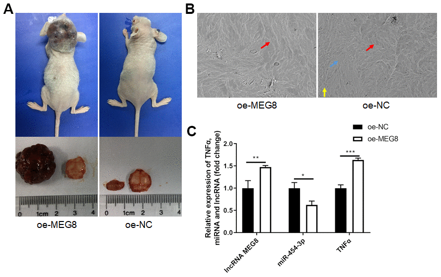 Overexpression of MEG8 promoted tumorigenesis and tumor progression in vivo. (A) Mice models, tumor volume and bone slices. (B) Scanning electron microscope results of bone slices (500x). (C) RT-qPCR analyses measured relative MEG8, miR-454-3p and TNF-α expression levels.