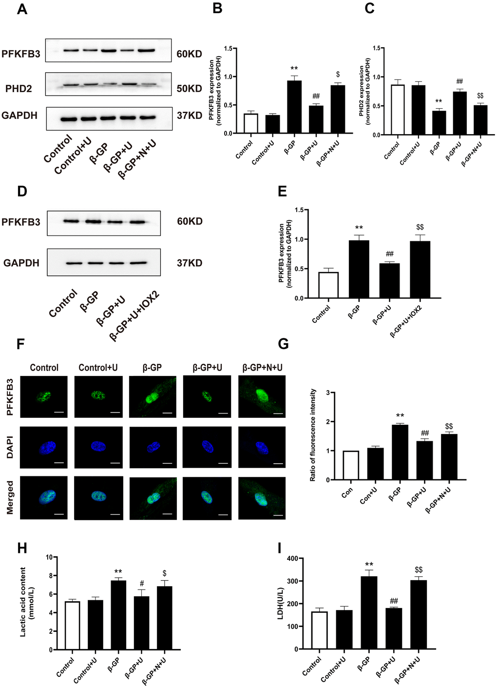 Effects of κ-OR stimulation on the expression of PFKFB3, PHD2, and glycolysis products in VSMCs treated with β-GP. (A) Representative blot images of PFKFB3 and PHD2. (B) Quantitative analysis of PFKFB3 protein expression using densitometry. (C) Quantitative analysis of PHD2 protein expression using densitometry. (D) Representative blot images of PFKFB3. (E) Quantitative analysis of PFKFB3 protein expression using densitometry. (F) After various treatments, PFKFB3 nuclear translocation was evaluated via immunofluorescence using confocal microscopy. At least 10-15 cells per condition were imaged. Scale bar = 10μm. (G) Quantification of PFKFB3 immunofluorescence intensity. (H, I) Lactic acid content and LDH levels were detected. U, U50,488H; β-GP, β-Glycerophosphate disodium salt pentahydrate; N, nor-BNI; Data obtained from quantitative densitometry were presented as means ± SEM. n=5 in each group. **P #P ##P $P $$P 