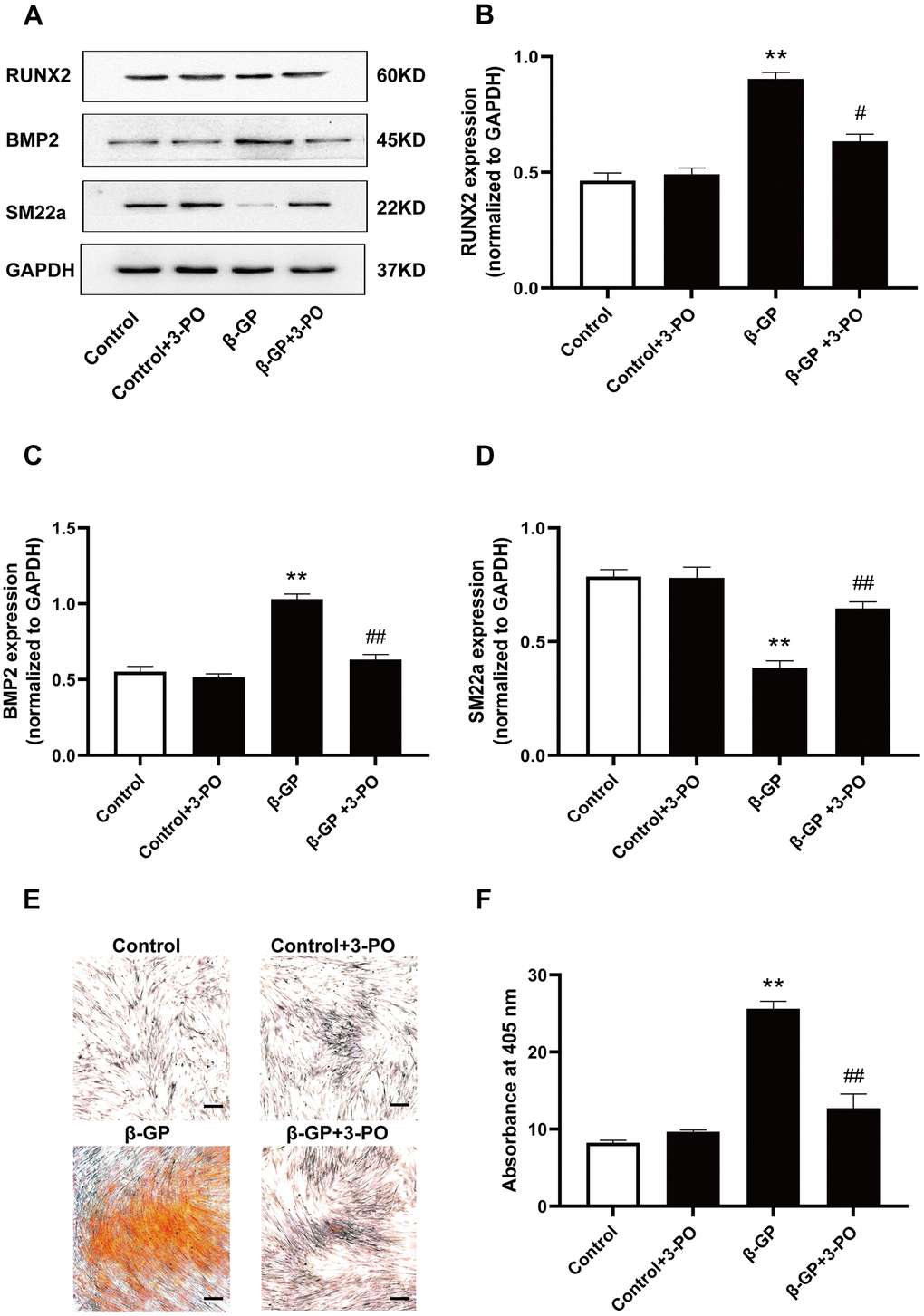 Effects on VSMC calcification induced by inhibiting PFKFB3 expression by β-GP. (A) Representative blot images of osteogenic differentiation-associated proteins. (B) Quantitative analysis of RUN2 protein expression using densitometry. (C) Quantitative analysis of BMP2 protein expression using densitometry. (D) Quantitative analysis of SM22a protein expression using densitometry. (E) Calcium nodules were stained with Alizarin red. Red nodules indicate calcium deposition. Scale bar = 50μm. (F) Quantification of mineralization. β-GP, β-Glycerophosphate disodium salt pentahydrate; Data were normalized using log10 and analyzed using one-way ANOVA tests; U, U50,488H; 3-PO, a novel small molecule inhibitor of the PFKFB3 isozyme; Data obtained from quantitative densitometry were presented as means ± SEM. n=5 in each group. **P #P ##P 