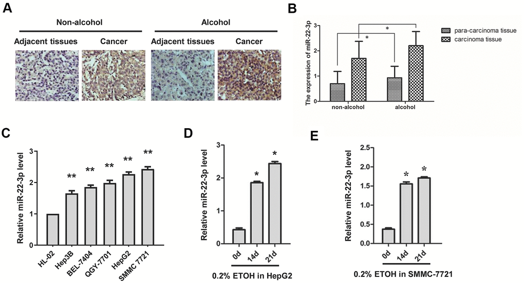 Expression of miR-22-3p in HCC tissues and cell lines with or without alcohol exposure. (A) ISH detection of miR-22-3p in adjacent and cancerous tissues of HCC patients with or without alcohol consumption history. Original magnification, ×400. (B) The miR-22-3p expression level in (A) is quantified and shown in column graph. n= 25. (C) Relative miR-22-3p level in HCC cells and normal liver cells. **PD) Relative expression level of miR-22-3p in HepG2 cells treated with alcohol for 0, 14 or 21 days. (E) Relative expression level of miR-22-3p in SMMC-7721 cells treated with alcohol for 0, 14 or 21 days.