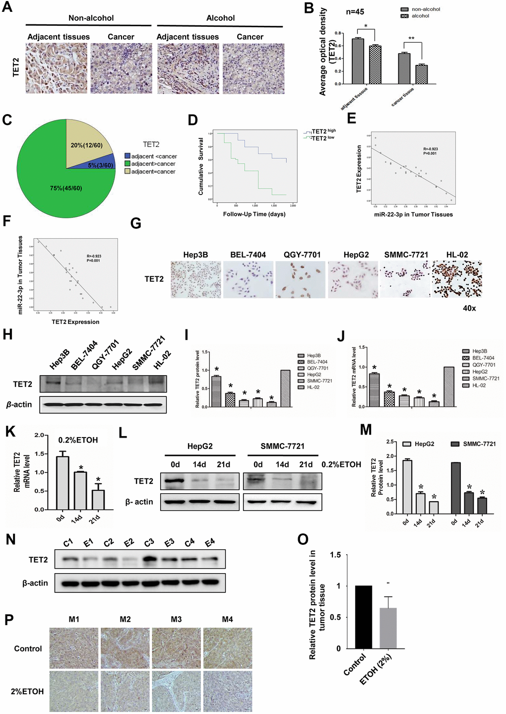 Expression of TET2 in HCC tissues and cell lines with or without alcohol exposure. (A) IHC detection of TET2 protein in adjacent and cancerous tissues of HCC patients with or without alcohol consumption history. Original magnification, ×400. (B) B is the quantification of A, n=45. (C) Statistical analysis of TET2 protein expression in adjacent and cancerous tissues of 60 HCC specimens. (D) Survival curve of HCC patients in TET2 high expression and low expression group. (E) Co-relationship analysis of miR-22-3p and TET2. R= -0.923, P= 0.001. (F) Co-relationship analysis of TET2 and miR-22-3p. R= -0.923, P= 0.001. (G) Protein level of TET2 in HCC cells and normal liver cells by cell IHC. Hep3B, BEL-7404, QGY-7701, HepG2 and SMMC-7721 are hepatocellular carcinoma cells while HL-02 is normal liver cells. (H) Protein level of TET2 in HCC cells and normal liver cells by Western blotting. (I) I is the quantification of H. (J) The relative mRNA level of TET2 in HCC cells and normal liver cells. (K) The mRNA expression levels of TET2 in HepG2 cells treated with 0.2% v/v alcohol for 0, 14, or 21 days. (L) The protein level of TET2 in HepG2 or SMMC-7721 cells treated with 0.2% v/v alcohol for 0, 14, or 21 days. (M) The protein level was quantified and shown in column graph. *PN) The protein level of TET2 in orthotopic liver tumors from the control group and alcohol drinking nude mice was analyzed by WB. Each group consisted of four mice. (O) The protein level of TET2 in N was quantified and shown in column graph. *PP) The protein level of TET2 in orthotopic liver tumors from the control group and alcohol drinking nude mice was analyzed by IHC. Each group consisted of four mice.