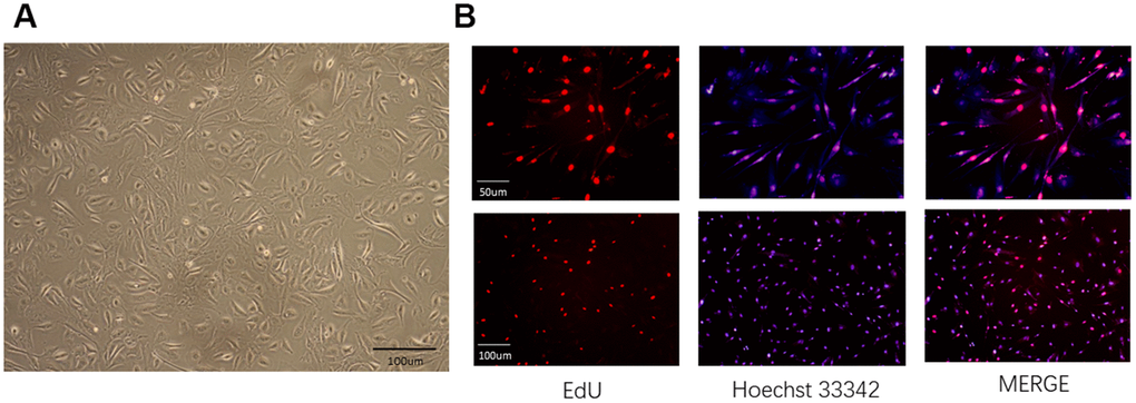 Characterization and labeling of human amniotic epithelial cells (hAECs). (A) The morphology of hAECs was observed under a microscope. (B) Immunofluorescence of hAECs labeled with EdU in vitro.