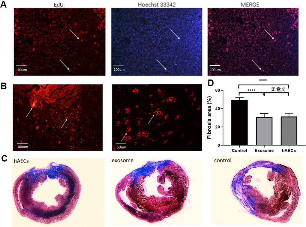 hAECs and exosomes implanted in the heart decrease the fibrosis area. (A) Immunofluorescence of hAECs in vivo 7 days after MI are shown. (B) Immunofluorescence of exosomes in vivo 7 days after MI are shown. (C) Representative images of four consecutive myocardial slices stained with Masson’s trichrome in the hAEC, exosome and control groups 28 days after MI are shown. (D) The bar graph shows quantitative analysis of the LV fibrosis area. The data are shown as the means ± SD, n=4, *P