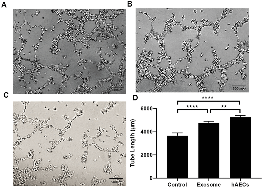 Lumen formation and quantitative analysis of the lumen length. Both hAECs and exosomes promote lumen formation. (A) Treatment with hAECs. (B) Treatment with exosomes. (C) Control group. (D) The bar graph shows quantitative analysis of the tube length. The data are shown as the means ± SD, n=4, *P