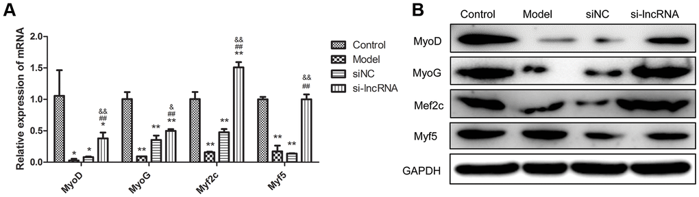 The effect of knock-down of PRKG1-AS1 on muscle regulatory factors. (A) qRT-PCR analyzes gene expression of MyoD, MyoG, Myf2c and Myf5. Dexamethasone (15 mM) was added in human skeletal muscle myoblasts to establish atrophy cell model. Si-PRKG1-AS1 or siNC was transfected into human skeletal muscle myoblasts and incubated for 48 h. * P P P P P B) Protein expression of MyoD, MyoG, Myf2c and Myf5 detected by western blot. Dexamethasone (15 mM) was added in human skeletal muscle myoblasts to establish atrophy cell model. Si-PRKG1-AS1 or siNC was transfected into human skeletal muscle myoblasts and incubated for 48 h.