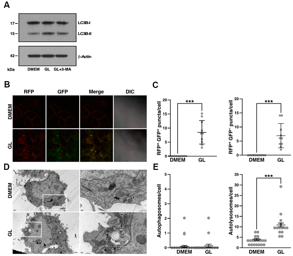 G. lucidum induces autophagy in human cells. (A) Effects of G. lucidum (GL) on LC3B-I and LC3B-II in human cells. Huh7 cells maintained in Dulbecco’s modified Eagle’s medium (DMEM) were treated with GL (1%) or DMEM for 12 hrs, prior to treatment with DMEM containing 3-methyladenine (3-MA, 2 mM) for 12 hrs. Protein levels were monitored by Western blot and normalized against actin. (B) GL induces the formation of autophagosomes and autolysosomes in human cells. Huh7 cells expressing monomeric red fluorescent protein (RFP)-LC3 and green fluorescent protein (GFP)-LC3 were treated with GL (1%) for 24 hrs, prior to fluorescence microscopy analysis. In differential interference contrast (DIC) images, cells are delineated in red for clarity. (C) Quantification of fluorescent puncta based on fluorescence microscopy. (D) Representative transmission electron microscopy (TEM) images of GL-treated cells. Huh7 cells were treated with GL (1%) for 24 hrs prior to fixation and thin-sectioning as described in Materials and Methods. Images on the right correspond to the insets delineated by white rectangles in the images on the left. An autolysosome is delineated by a white dashed line for the GL panel. (E) Quantification of autophagosomes and autolysosomes based on TEM. ***p
