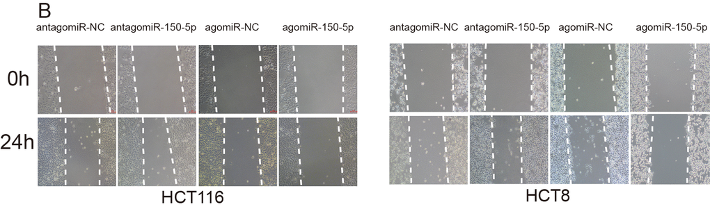 (A-D) Representative images of colony formation (A), wound healing (B, x40), transwell (C, x200) and tube formation (D, x100) in antagomiR-NC group, antagomiR-150-5p group, agomiR-NC group and agomiR-150-5p group.