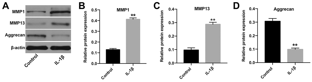 In vitro model of OA was successfully established. (A) CHON-001 cells were treated with 10 ng/mL IL-1β for 48 h. Next, the expression of MMP-1, MMP-13, and Aggrecan in CHON-001 cells was detected by western blotting. (B) The relative expression of MMP-1 was quantified by normalizing it to that of β-actin. (C) The relative expression of MMP-13 was quantified by normalizing it to that of β-actin. (D) The relative expression of Aggrecan was quantified by normalizing it to that of β-actin. **p 