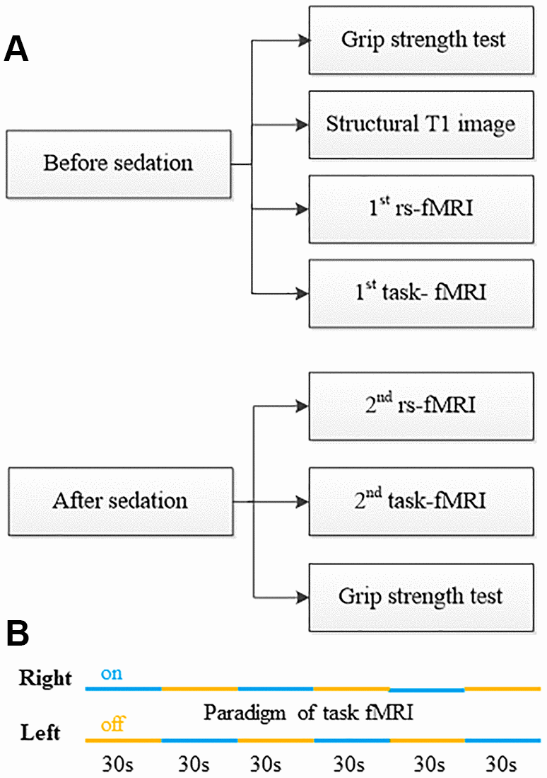 Work flow of physiological test, fMRI data acquisition and sedation protocol. (A) Study work flow. (B) Paradigm of task-fMRI.