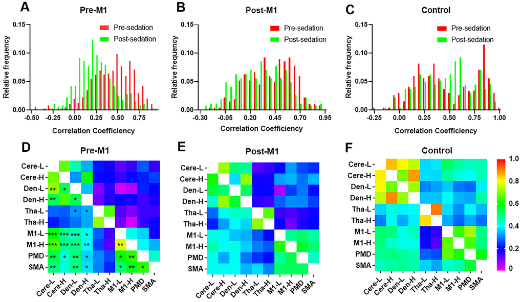 The stability and distribution of functional connectivity (FC) within motor network. Distribution of individual FCs in M1 group (A) and post-M1 group (B) shifted to the lower FCs after sedation (p C). (D–F) FCs within brain motor networks before (lower part of each matrix) and after (upper part of each matrix) sedation in three groups. (D) Most FCs within motor networks decreased significantly after sedation in M1 group (p[FDR] E) or control group (F) (* P P P 