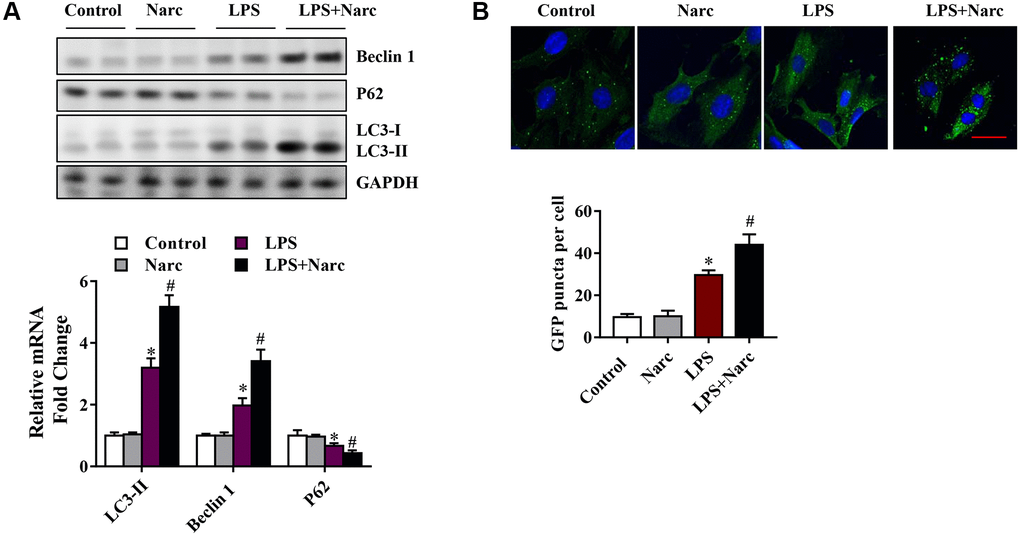 Narciclasine upregulates autophagy in a mouse model of LPS-induced myocardial injury. (A) Western blot analysis of autophagy markers, including Beclin-1, p62 and microtubule-associated light chain (LC)-3, in heart tissue. (B) The autophagy level was measured by live-cell imaging using Ad-GFP-LC3. Scale bar, 20 μm. n = 3 per group. The data are shown as the means ± SEM. *P #P 