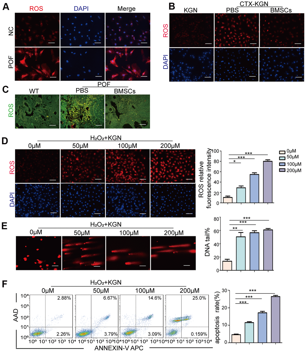 Oxidative stress induces DNA damage and apoptosis in GCs. (A) ROS of GCs of women with normal ovarian function and POF patients was assessed via DHE probes. Scale bar: 100μm. (B) ROS in the KGN, CTX-KGN-PBS and CTX-KGN-BMSCs groups were assessed using DHE probes. Scale bar: 100μm. (C) ROS in the ovaries of the WT, POF-PBS and POF-BMSCs groups were assessed using DCFH-DA probes. Scale bar: 100μm. (D) Cells were treated with 0 μM to 200 μM H2O2 for 1 hour. Total production of ROS was assessed using DHE probes. Scale bar: 100μm. (E) The DNA damage of cells treated with H2O2 was measured via comet assay. Scale bar: 100μm. Comparison of the tail of DNA between the groups. (F) Apoptosis of H2O2+KGN was assessed using Annexin V staining. Comparison of apoptotic rates between the groups.