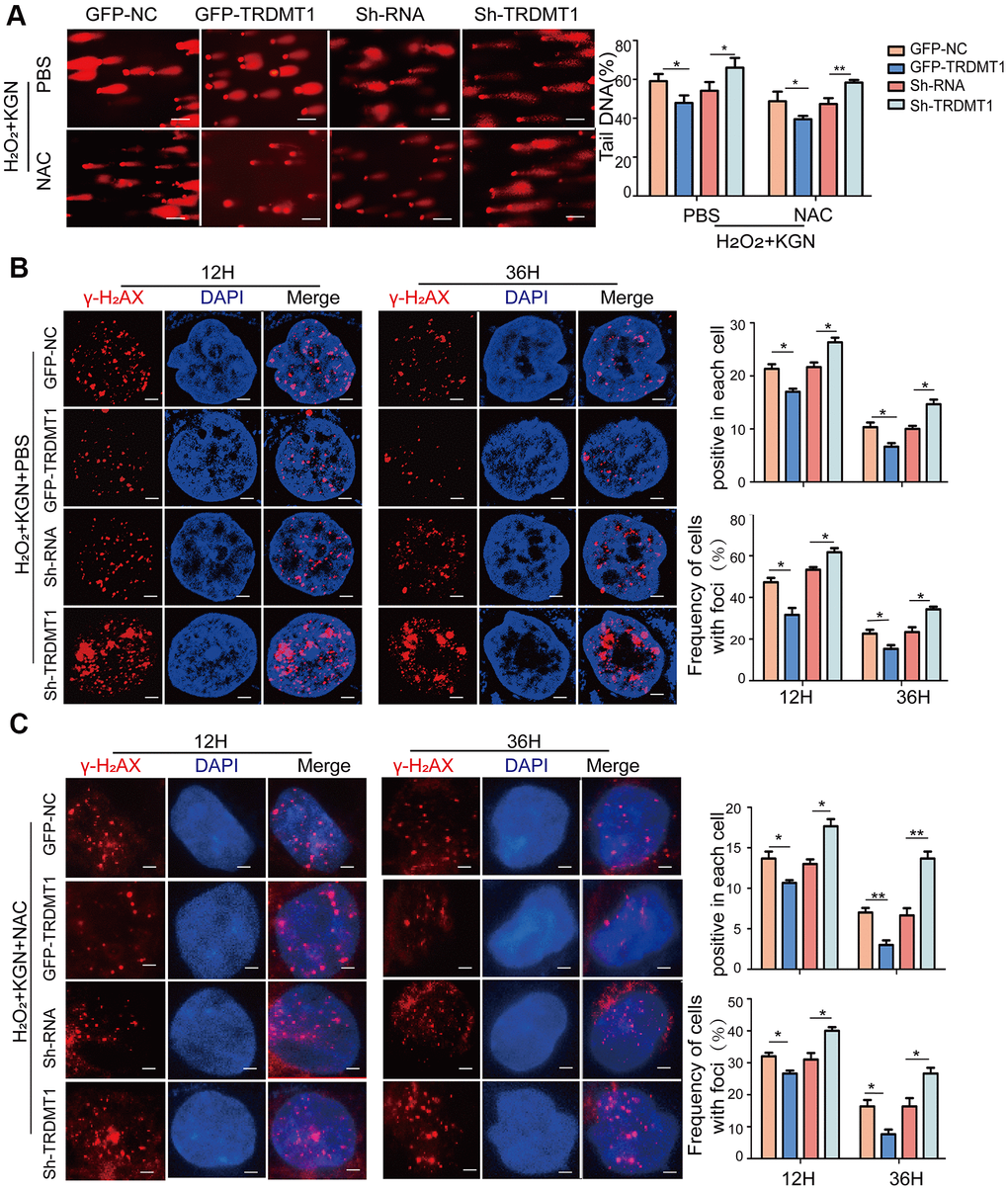 TRDMT1 mediates GCs oxidative DNA damage repair. (A) The DNA damage of H2O2+KGN+PBS and H2O2+KGN+NAC transfected with GFP-NC, GFP-TRDMT1, Sh-RNA and Sh-TRDMT1 was measured via comet assay. Scale bar: 100μm. Comparison of the tail of DNA between the groups. (B) H2O2+KGN+PBS transfected with GFP-NC, GFP-TRDMT1, Sh-RNA and Sh-TRDMT1 were harvested at the indicated time points for γ-H2AX staining. Positive cells in each cell and the frequency of cells with foci were counted. Scale bar: 10μm. (C) H2O2+KGN+NAC transfected with GFP-NC, GFP-TRDMT1, Sh-RNA and Sh-TRDMT1 were harvested at the indicated time points for γ-H2AX staining. Positive cells in each group and the frequency of cells with foci were counted. Scale bar: 10μm.*P