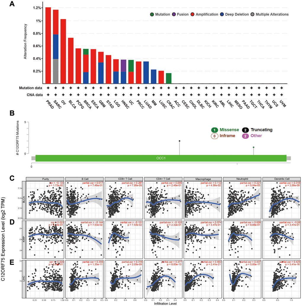 Mutation feature of C12orf75 in different tumors of TCGA and correlation of C12orf75 expression with immune infiltration level in BLCA, KIRP, and LIHC. The alteration frequency with mutation type (A) and mutation site (B) are displayed. (C) In BLCA, C12orf75 expression has a significant negative correlation with tumor purity, a significant positive correlation with infiltrating levels of CD8+ T cell, macrophage, neutrophil, and dendritic cell, and no relation with infiltrating levels of B cell and CD4+ T cell. (D) In KIRP, C12orf75 expression has no significant correlation with tumor purity, significant negative correlation with infiltrating levels of B cell and, CD8+ T cell, and no relation with infiltrating levels of CD4+ T cell, macrophage, neutrophil, and dendritic cell. (E) In LIHC, C12orf75 expression has no significant correlation with tumor purity and, significant positive correlation with infiltrating levels of B cell, CD8+ T cell, CD4+ T cell, macrophage, neutrophil, and dendritic cell. ACC, adrenocortical carcinoma; AML, acute myeloid leukemia; BLCA, bladder urothelial carcinoma; BRCA, breast invasive carcinoma; CESC, cervical squamous cell carcinoma and endocervical adenocarcinoma; CHOL, cholangiocarcinoma; CRAC, colorectal cancer; DLBC, lymphoid neoplasm diffuse large B-cell lymphoma; ESCA, esophageal carcinoma; GBM, glioblastoma multiforme; HNSC, head and neck squamous cell carcinoma; KICH, kidney chromophobe; KIRC, kidney renal clear cell carcinoma; KIRP, kidney renal papillary cell carcinoma; LGG, brain lower grade glioma; LIHC, liver hepatocellular carcinoma; LUAD, lung adenocarcinoma; LUSC, lung squamous cell carcinoma; MESO, mesothelioma; MM, malignant melanoma; OV, ovarian serous cystadenocarcinoma; PAAD, pancreatic adenocarcinoma; PCPG, pheochromocytoma and paraganglioma; PRAD, prostate adenocarcinoma; PRCC, papillary renal cell carcinoma; SARC, Sarcoma; STAD, Stomach adenocarcinoma; TGCT, testicular germ cell tumors; THCA, thyroid carcinoma; THYM, thymoma; UC, uterine cancer; UCS, uterine carcinosarcoma; UVM, uveal melanoma. P-values were corrected using the Benjamini-Hochberg method. p 