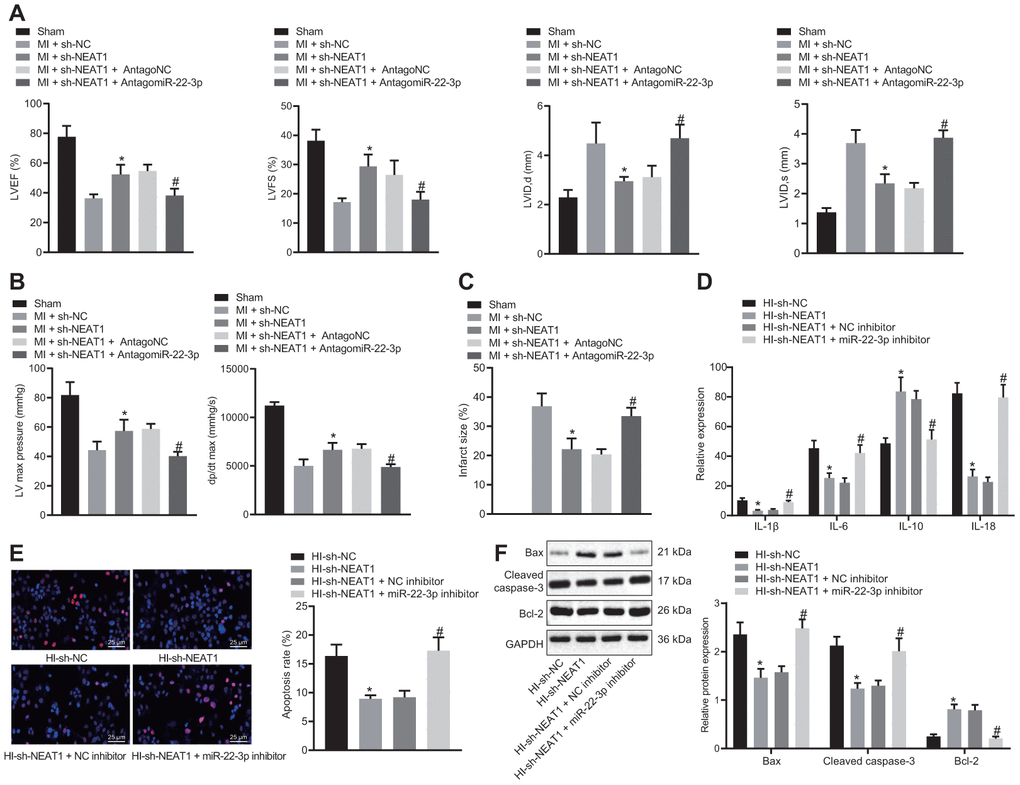 NEAT1 aggravates myocardial injury in mice with CHD via upregulation of Ltb4rl by sponging miR-22-3p. MI mice were injected with sh-NEAT1 and/or AntagomiR-22-3p. (A) Quantification of LVEF, LVIDD, LVIDs, LVEF, LVFS, in myocardial tissues of MI mice. (B) Hemodynamic analysis of LV and dP/dt in myocardial tissues of MI mice. (C) The infarct size in myocardial tissues of MI mice detected using TTC staining upon treatment with sh-NEAT1, sh-NC, AntagoNC, or AntagomiR-22-3p. A-C * p vs. MI + sh-NC and # p vs. MI + sh-NEAT1 + AntagomiR NC. (D) ELISA of IL-1β, IL-6, and IL-18 in hypoxia-induced MI cardiomyocytes upon treatment with sh-NEAT1, sh-NC, AntagoNC, or AntagomiR-22-3p. (E), Apoptosis of hypoxia-induced MI cardiomyocytes detected using TUNEL staining (× 400). (F) Protein levels of Cleaved caspase-3, Bax, and Bcl-2 in hypoxia-induced MI cardiomyocytes determined using Western blot analysis, normalized to GAPDH. * p vs. MI mice injected with sh-NC or hypoxia-induced MI cardiomyocytes treated with sh-NC and # p vs. MI mice injected with sh-NEAT1 + AntagomiR NC or hypoxia-induced MI cardiomyocytes treated with sh-NEAT1 + NC inhibitor. Data among groups were analyzed by one-way ANOVA/Tukey’s test.