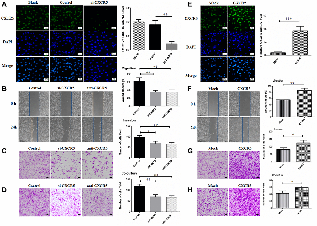 Silencing CXCR5 attenuates migration, invasion and PNI in SACC cells. (A) Immunofluorescence and qRT-PCR analysis showed that CXCR5 expression was dramatically inhibited by siRNA treatment. (B–D) CXCR5 silence with siRNA or CXCR5 blockade with anti-CXCR5 antibody impeded migration, invasion and PNI of SACC-LM cells, (Bar: 100 μm). (E) Immunofluorescence and qRT-PCR analysis showed that CXCR5 level was significantly increased by CXCR5-overexpressing plasmid. (F–H) CXCR5 overexpression enhanced migration, invasion and PNI capacity of SACC-LM cells, (Bar: 100 μm) (*p **p ***p 