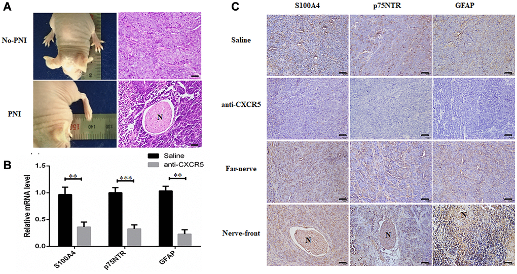 Inhibition of CXCR5 suppresses PNI in SACC xenograft model. (A) Representative images on hindlimb function of the mouse and HE staining were presented. (B) qRT-PCR analysis showed that anti-CXCR5 antibody group mice showed reduced expression of S100A4, p75NTR and GFAP compared with saline group mice. (C) Immunohistochemical staining showed that anti-CXCR5 antibody group mice showed reduced expression of S100A4, p75NTR and GFAP compared with saline group mice. The expression of S100A4, p75NTR, GFAP was higher at nerve invasion frontier than that in tumors far away from nerve in PNI groups, ‘N’ represented nerve, (Bar: 50 μm) (**p ***p 