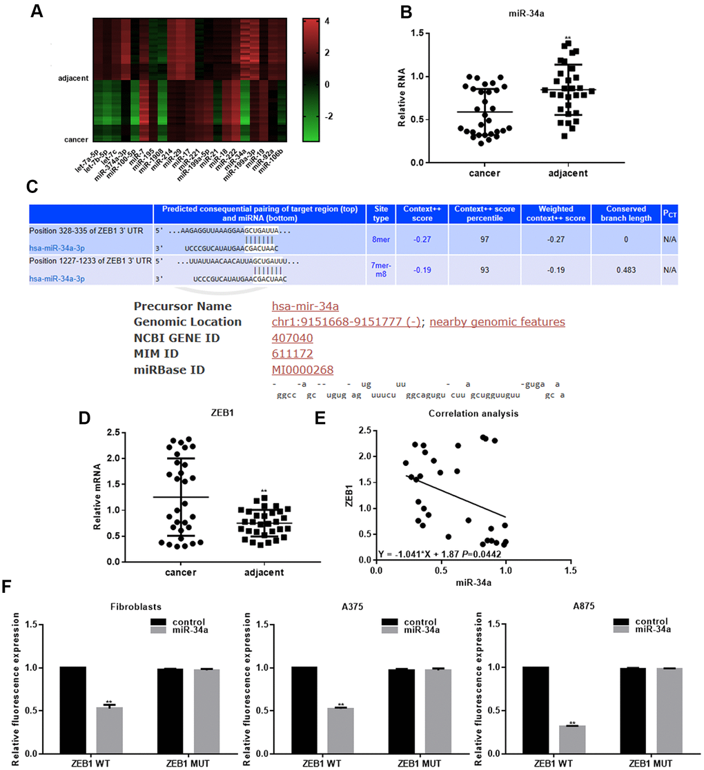 miR-34a targets ZEB1 in melanoma. (A) Microarray analysis of differentially expressed miRNAs in melanoma tissues and adjacent tissues. (B) Real-time PCR analysis of miR-34a in melanoma and adjacent tissues (mean ± SEM; ** PC) Targetscan and MIRDB analysis indicating that miR-34a binds to the 3'UTR region of ZEB1. (D) Real-time PCR analysis of ZEB1 in melanoma and adjacent tissues (mean ± SEM; ** PE) Negative correlation between miR-34a and ZEB1 expression in melanoma. (F) Luciferase reporter assay demonstrating that miR-34a inhibits ZEB1 WT activity, but not ZEB1 MUT activity; ** P