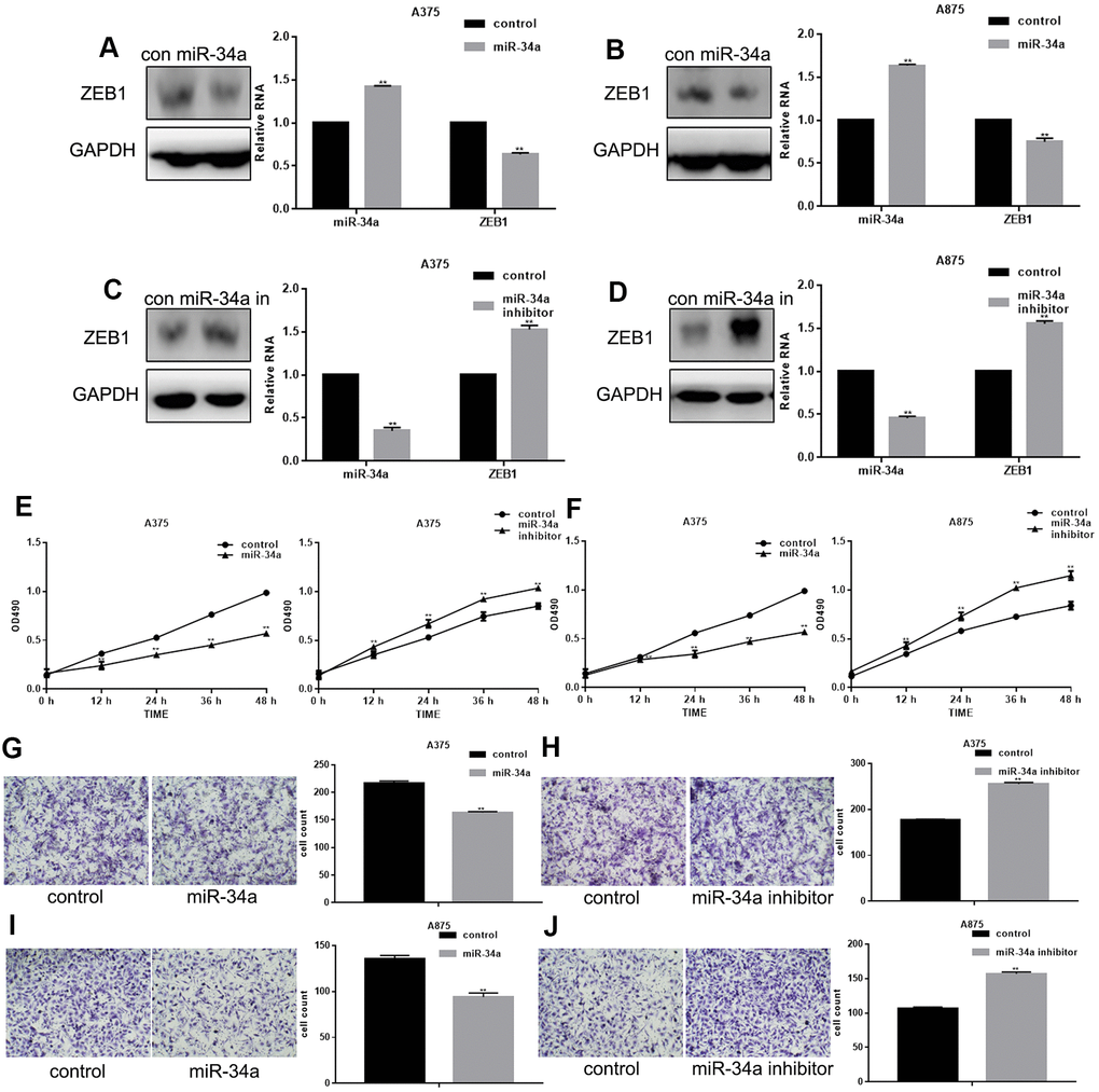 miR-34a inhibits proliferation and migration of melanoma cells. (A, B) Western blotting and real-time PCR analysis of miR-34a and ZEB1 in cells overexpressing miR-34a;** PC, D) Western blotting and real-time PCR analysis of miR-34a and ZEB1 in cells with down-regulated miR-34a expression;** PE, F) MTT cell proliferation assay in A375 and A875 cells transfected with miR-34a mimic/inhibitor (mean ± SEM; ** PG–J) Transwell cell migration assay in A375 and A875 cells transfected with miR-34a mimic/inhibitor (mean ± SEM; ** P