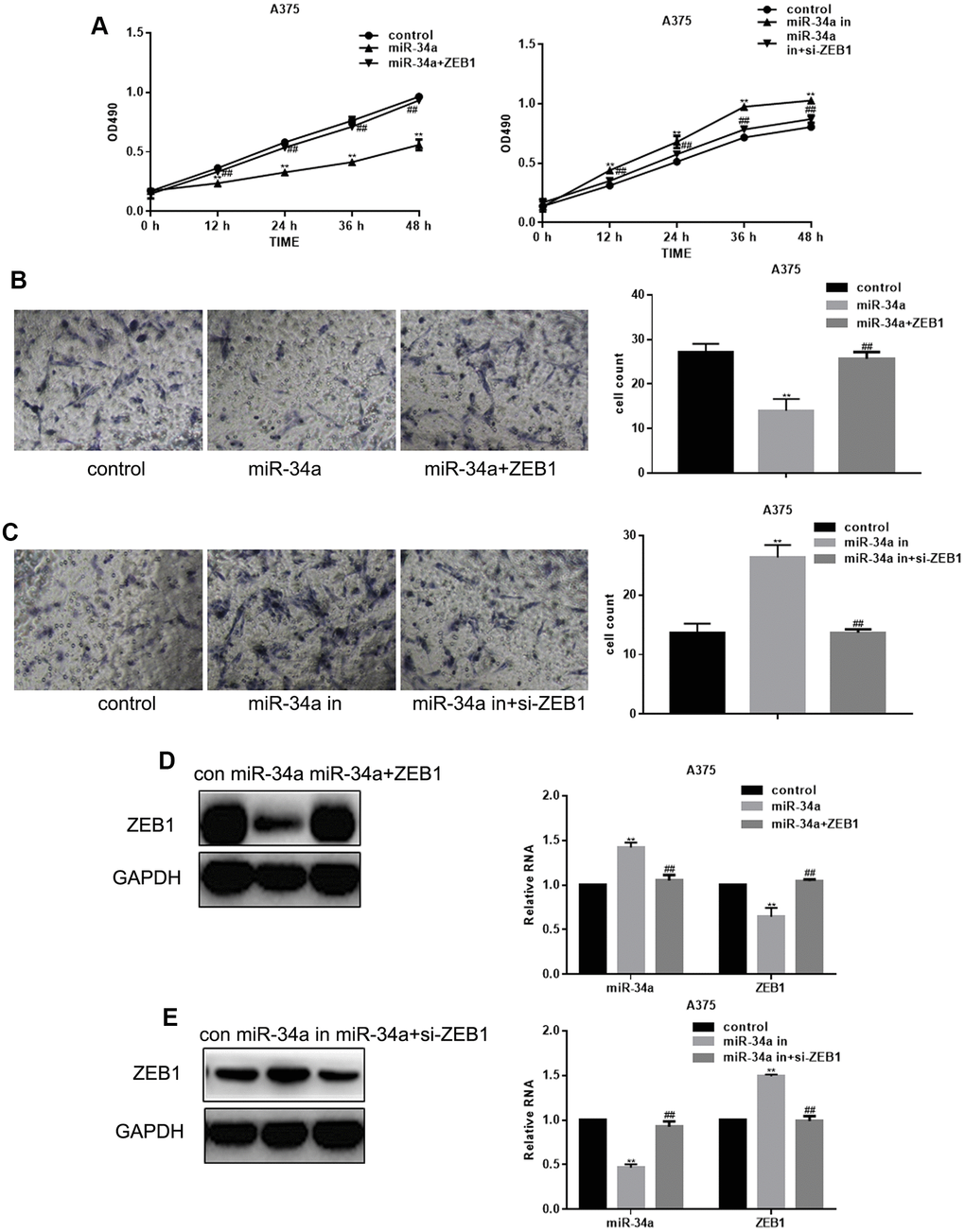 miR-34a inhibits proliferation and migration of melanoma cells by targeting ZEB1. (A) MTT cell proliferation assay in A375 cells with increased and suppressed miR-34a expression, and transfected with ZEB1 or ZEB1 siRNA (mean ± SEM; ** PPB) Transwell migration assay in A375 cells overexpressing miR-34a and transfected with ZEB1 (mean ± SEM; ** PPC) Transwell migration assay of A375 cells with downregulated miR-34a and transfected with si-ZEB1 (mean ± SEM. ** PPD) Western blotting and real-time PCR analysis of miR-34a and ZEB1 in A375 cells transfected with ZEB1 and overexpressing miR-34a (mean ± SEM; ** PPE) Western blotting and real-time PCR analysis of miR-34a and ZEB1 in A375 cells with downregulated miR-34a and transfected with si-ZEB1 (mean ± SEM; ** PP