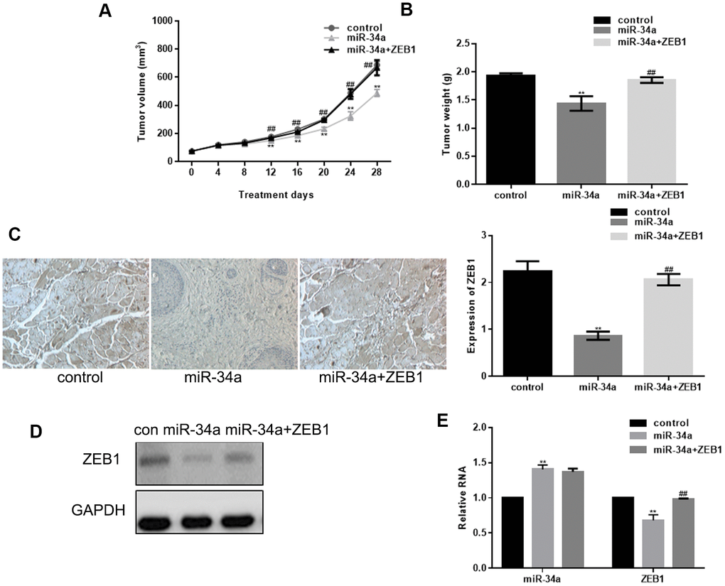 miR-34a inhibits in vivo growth of melanoma by targeting ZEB1. (A, B) Tumor volume and weight in nude mice 28 days after injection with miR-34a and ZEB1 transfection (mean ± SEM; ** PPC) Immunofluorescence staining of ZEB1 showing increased ZEB1 expression in control group than in miR-34a group, and in miR-34a+ZEB1 group than in miR-34a group (** PPD, E) miR-34a could significantly down regulate ZEB1 expression. ZEB1 transfection attenuated the effect of miR-34a. Data are shown as mean ± SEM. ** PP