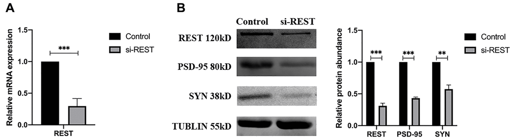 REST knockdown reduced the synaptophysin (SYN) and PSD-95 expression in the primary mouse hippocampal neurons. (A) REST was successfully knocked down in the primary mouse hippocampal neurons. n = 3. (B) SYN and PSD-95 was deregulated after knockdown of REST. n = 3. Independent experiments were performed three times. Data are expressed as mean ± SEM. *p 